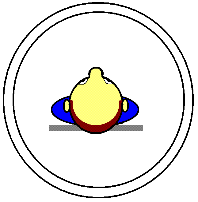 PET1